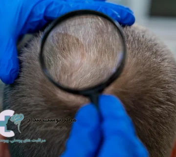 بانک مو چیست