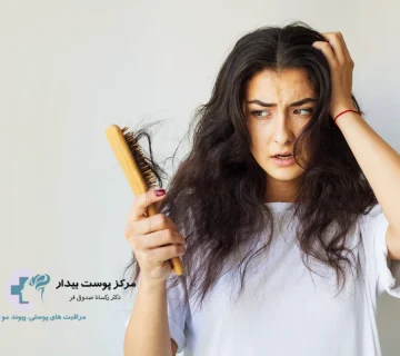 علت ریزش ناگهانی مو