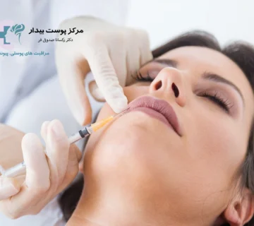 تفاوت فیلر لب با ژل لب