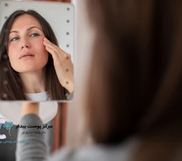 تشخیص نوع پوست صورت