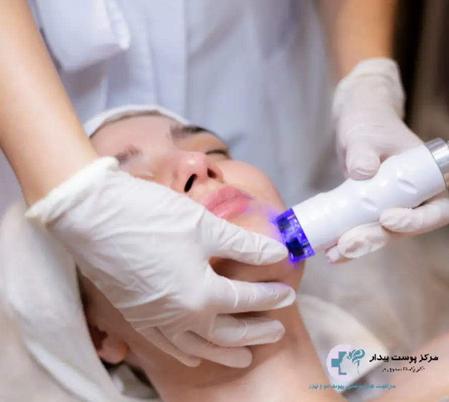 اندولیفت چیه؟