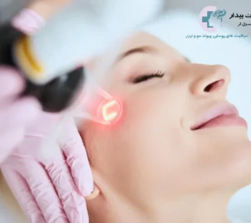 لیزر اندولیفت چیست