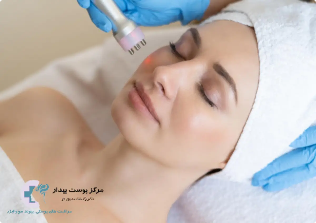 اندولیفت چیست و چقدر ماندگاری دارد