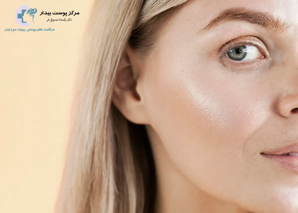 چند نوع پوست داریم