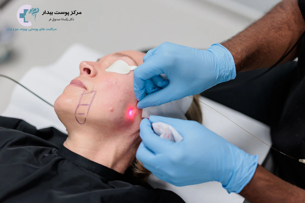 اندولیفت برای چه سنی مناسب است